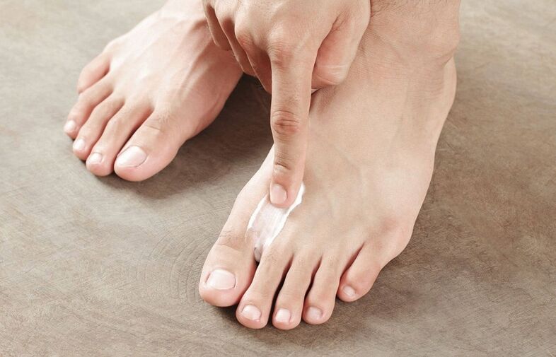 мехлем за лечение на гъбички по ноктите на краката