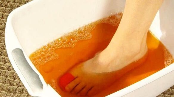 йодна баня срещу гъбички по краката
